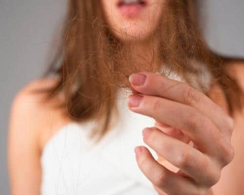 Can lotion make your hair fall out